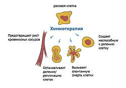 химия при онкологии